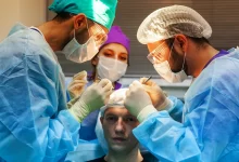 Hair Transplant in Turkey (Clinics and Methods)