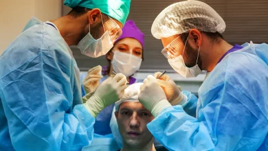 Hair Transplant in Turkey (Clinics and Methods)