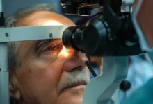 Cataract surgery Turkey